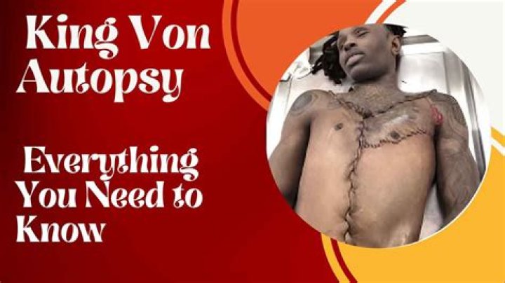Disturbing Details Emerge In King Von Autopsy Report