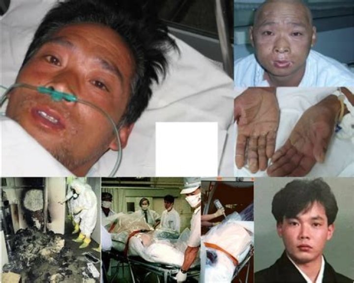 Hisashi Ouchi: A Tragic Tale Of Radiation Exposure