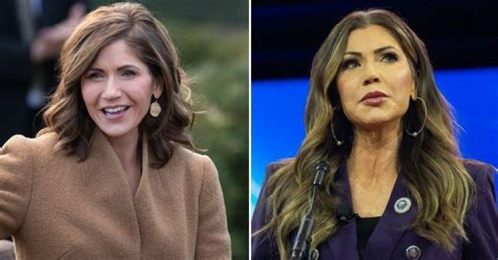 Kimberly Guilfoyle Enhances Her Beauty: A Plastic Surgery Journey