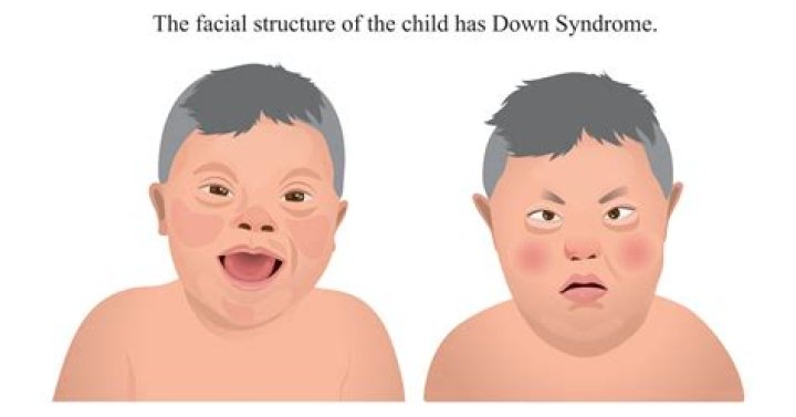 Understanding The Journey: Hugh Grant's Daughter With Down Syndrome