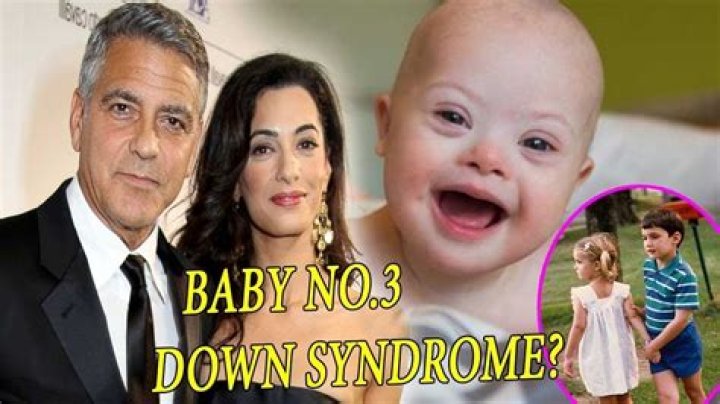 Understanding The Truth: Does George Clooney's Child Have Down Syndrome?