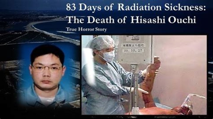 Unraveling The Tragic Story Of Hisashi Ouchi: A Tale Of Human Resilience And Suffering
