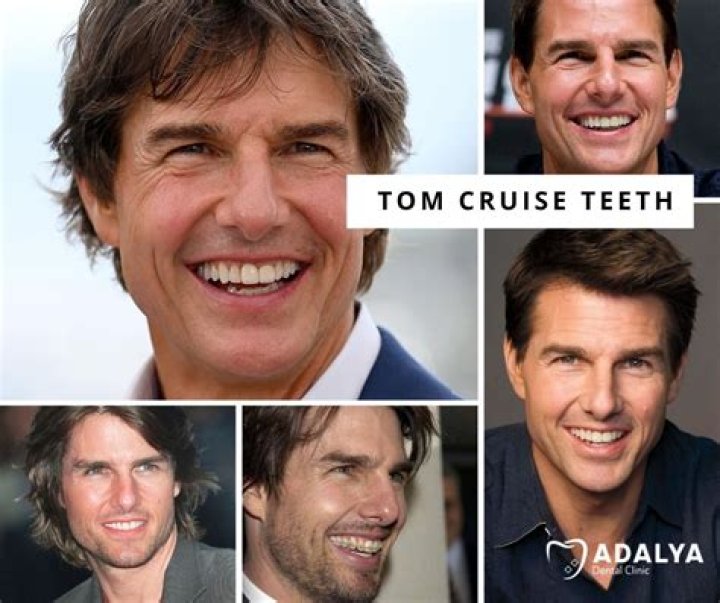 Unveiling The Mystery Behind Tom Cruise’s Iconic Tooth