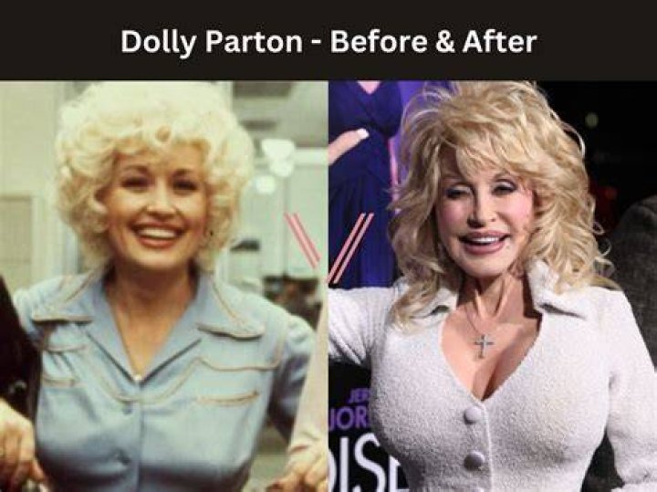 Unveiling The Truth: Are Dolly Parton's Boobs Fake?
